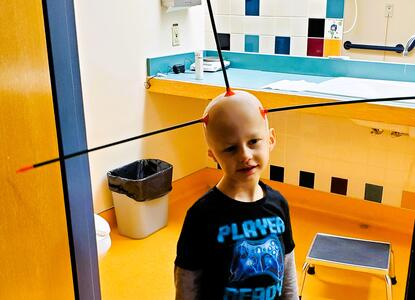 Theo so bald that arrows stick to his head during pediatric blood cancer treatment
