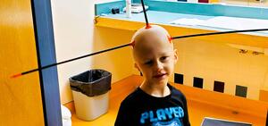 Theo so bald that arrows stick to his head during pediatric blood cancer treatment